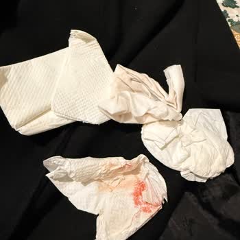 Trendyolmilla Kullanılmış ve Kirli Kaban Teslim Edildi