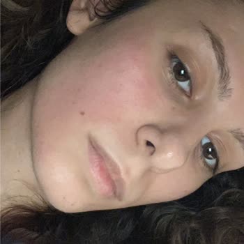 Kiko Milano Skin Hybrid Tint Ürününün Kimyasal Yanığı Ve Sessiz Müşteri Hizmetleri