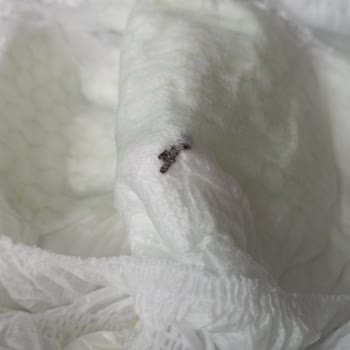 Bebem Natural 5 Numaralı Bezde Tanımsız Madde Ve Sağlık Şikayeti