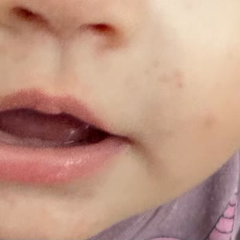 Sma Optipro Rahatsız Edici Koku