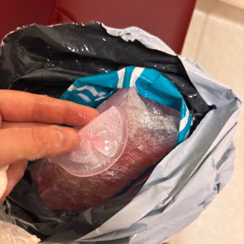 Sürat Kargo İle Hasarlı Ürün Teslimatı Ve Tazminat Talebi