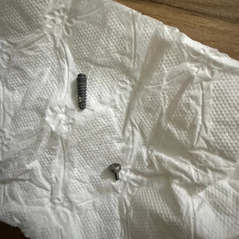 Sağlık Bakanlığı Tamamlanmayan İmplant Tedavisi ve Düşen İmplant Nedeniyle İade Talebi