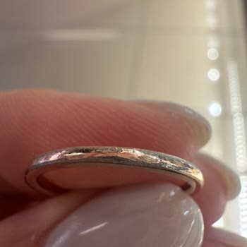 Kaplamalı Yüzüğümde Renk Soyulması Ve Mağazanın Bakım İhmali