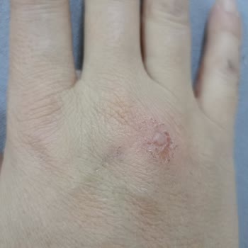 Soframa Doğal Ürünler Mağdur Etti!