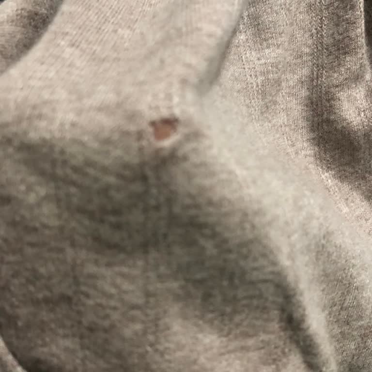 İntimissimi Mağazasında Pijama Delik Sorunu Ve Değişim İsteği