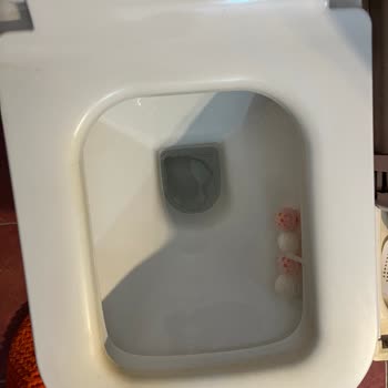 Kısa Sürede Sararan Kale Klozetimiz Ayıplı Ürün