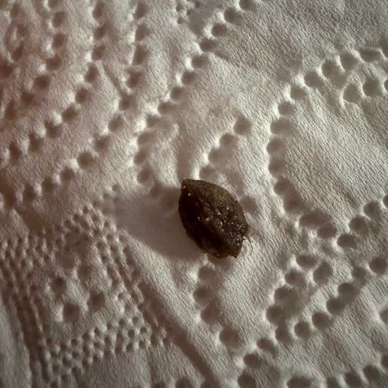 Pizza İçinde Zeytin Çekirdeği Bulunması Hijyen Şikayeti Ve Ücret İadesi Talebi