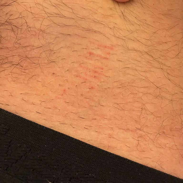 Cilt Tahrişi Yaşadığım Philips Erkek Bakım Setine İade Ve Değişim Talebi