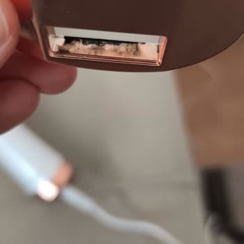 İkinci Kullanımda Patlayan IPL Epilasyon Makinesi Ve Yanık Şikayeti