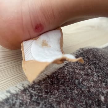 Botun Ayak Yaralanmasına Neden Olması Ve Değişim Talebinin Reddedilmesi