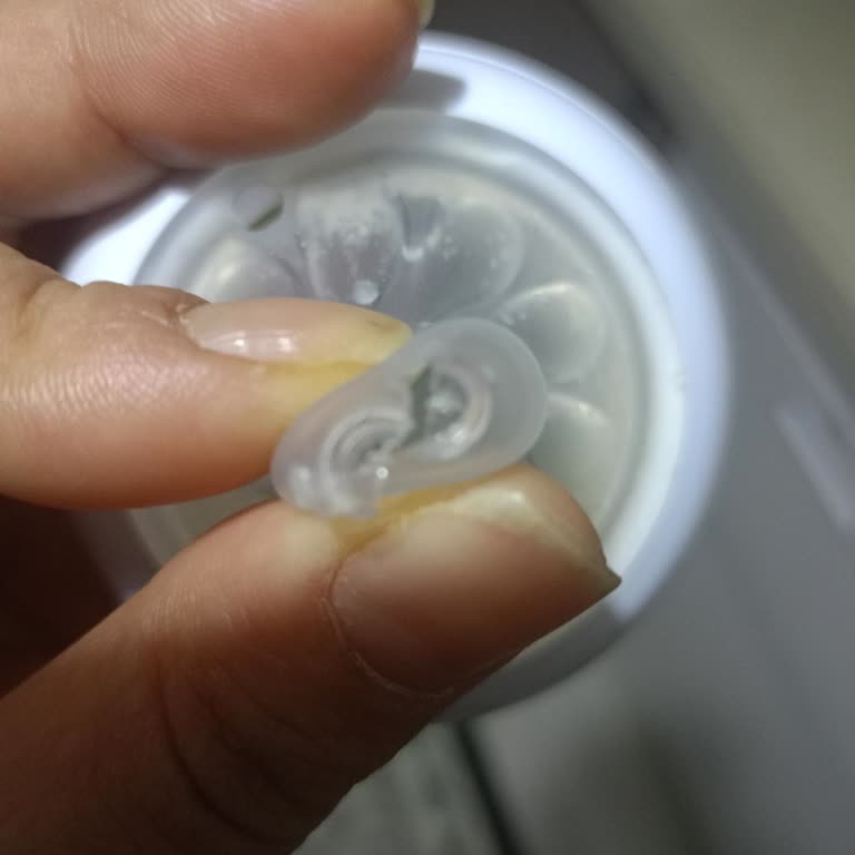 Biberon Ucunun Yırtılması Ve Philips Avent'ten Yardım Alamama