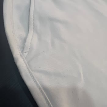 Avva Pantolonundaki Cep Tüylenmesi Kullanıcı Hatası Olarak Reddedildi