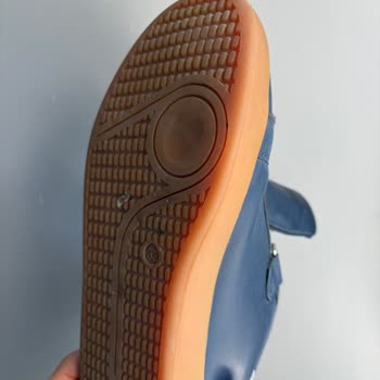 Vicco Çocuk Ayakkabılarının Hızlı Deformasyonu Ve İade Talebi