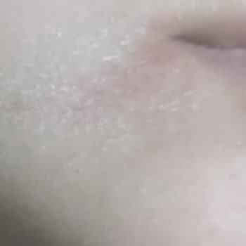 İade Talebiyle Şiddetli Cilt Tahrişi Yaratan Yüz Yıkama Jeli