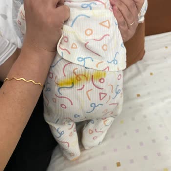 Sleepy Bebek Bezi Sızıntı Ve Emicilik Sorunu Büyük Hayal Kırıklığı