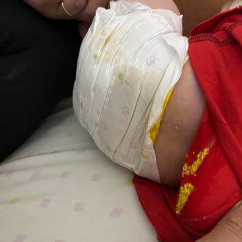 Sleepy Bebek Bezi Sızıntı Ve Emicilik Sorunu Büyük Hayal Kırıklığı