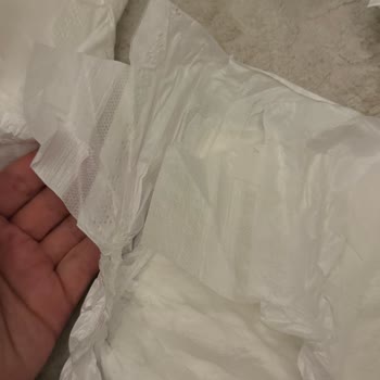 Üretim Hatası Nedeniyle Bebek Bezlerinde Sağ Yan Bant Eksikliği