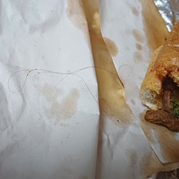 Saç Çıkan Tantuniden Tam İade Talebi Ve Yetersiz Müşteri Desteği Şikayeti