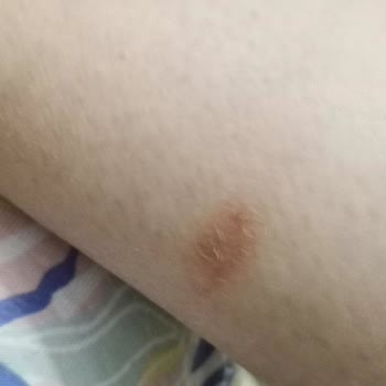 Sağlık Sorunum Göz Ardı Edilen Bot İadesi Reddedildi