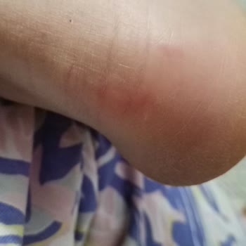 Sağlık Sorunum Göz Ardı Edilen Bot İadesi Reddedildi