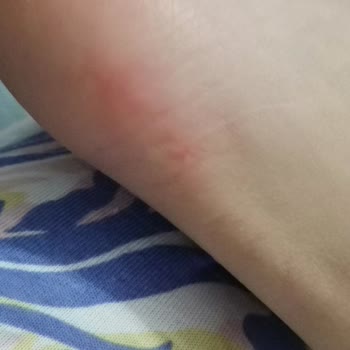 Sağlık Sorunum Göz Ardı Edilen Bot İadesi Reddedildi