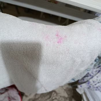 Ariel Pods Dağ Esintisi Ürünü Beyaz Çamaşırlarıma Kırmızı Leke Bıraktı, İade Ve Telafi Talebi