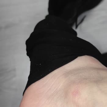 Ayıplı Outdoor Botta Taban Kayması Nedeniyle Bilek Ağrısı Ve İade Reddi