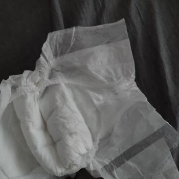 Molfix 3 Numaralı Bebek Bezinde Cırt Bant Yokluğu Ve Değişim İsteği