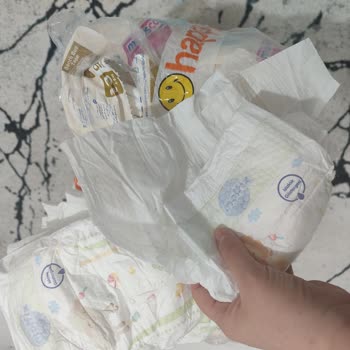 Molfix 3 Numaralı Bebek Bezinde Cırt Bant Yokluğu Ve Değişim İsteği