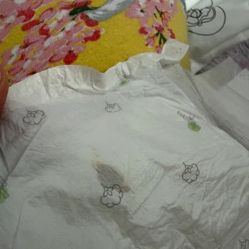 Sleepy Bebek Bezinde Yabancı Madde Tespiti Ve Sağlık Endişesi