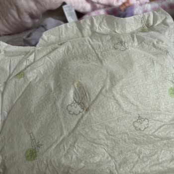 Sleepy Bebek Bezinde Yabancı Madde Tespiti Ve Sağlık Endişesi