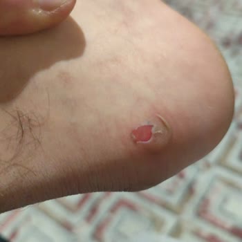 Defolu Bot, Eğri Topuk Ve Boya Dökülmesi; Değişim Talebim Reddedildi