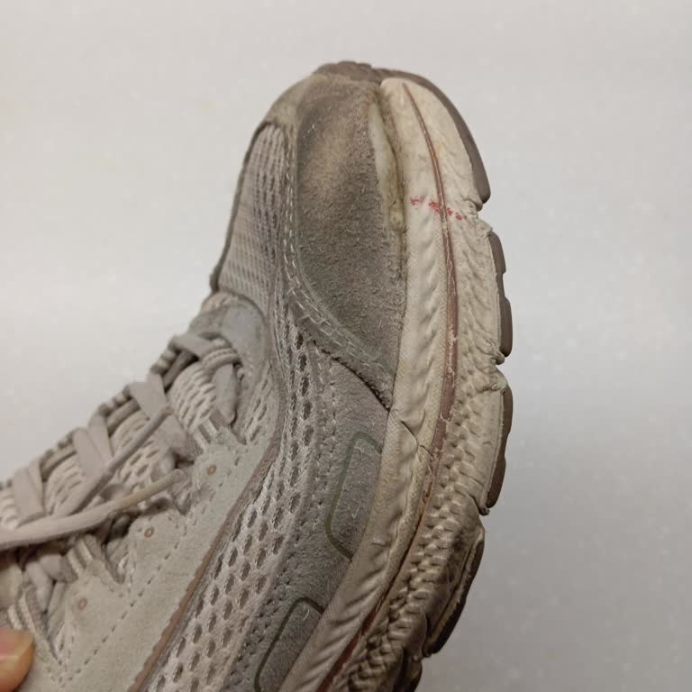 SuperStep Skechers Ayakkabısı 3 Ayda Açıldı, Kullanıcı Hatası İddiası