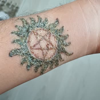 Başakşehir Esse Life Güzellik Merkezinde Dövme Silme İşleminde Başarısızlık Ve Ücret İadesi Talebi