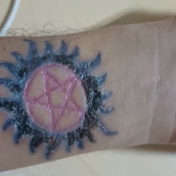 Başakşehir Esse Life Güzellik Merkezinde Dövme Silme İşleminde Başarısızlık Ve Ücret İadesi Talebi