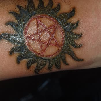 Başakşehir Esse Life Güzellik Merkezinde Dövme Silme İşleminde Başarısızlık Ve Ücret İadesi Talebi