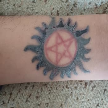 Başakşehir Esse Life Güzellik Merkezinde Dövme Silme İşleminde Başarısızlık Ve Ücret İadesi Talebi