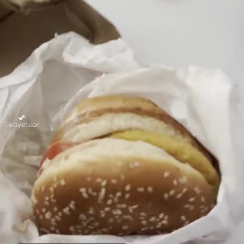Burger King Alerjiye Rağmen İçine Koyulan Malzeme!