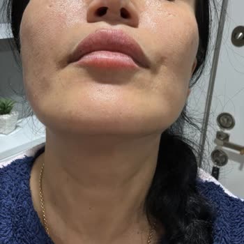 Estethica Ataşehir'de Yaşanan Pişmanlık