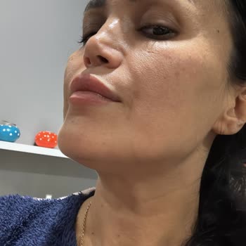 Estethica Ataşehir'de Yaşanan Pişmanlık