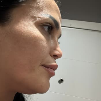 Estethica Ataşehir'de Yaşanan Pişmanlık