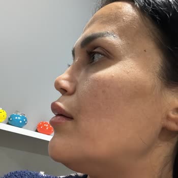 Estethica Ataşehir'de Yaşanan Pişmanlık