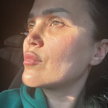 Estethica Ataşehir'de Yaşanan Pişmanlık