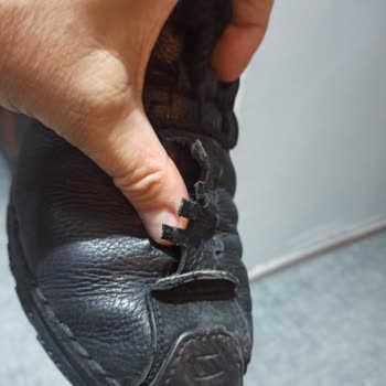 Hotiç Ayakkabısında Erken Aşınma Ve İade Reddi