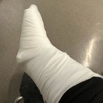 IKEA Kapalı Otoparkta Güvenlik Önlemi Olmadan Ayak Bileği Kırılması Ve Ciddi Mağduriyet