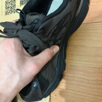 Kalitesiz Ayakkabıda Erken Deformasyon Ve Yetersiz Müşteri Hizmetleri