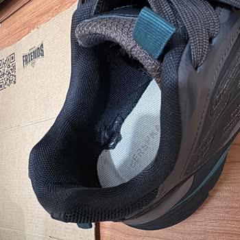 Kalitesiz Ayakkabıda Erken Deformasyon Ve Yetersiz Müşteri Hizmetleri