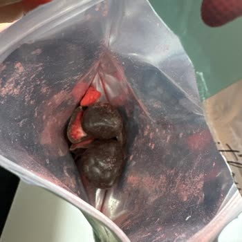 Durukan Drajede Gramaj Uyuşmazlığı Ve Yanıltıcı Ambalaj