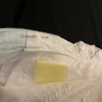 Prima Premium Care 5 Numaralı Bebek Bezinde Sızıntı Ve Şiddetli Pişik Şikayeti