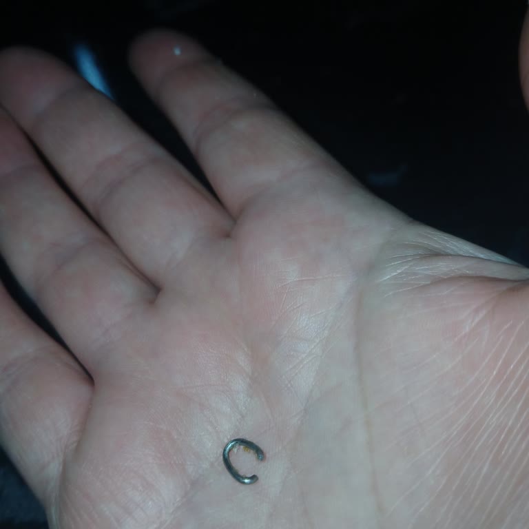 Erpiliç Şinitzel Ürünün İçinde Metal Parça